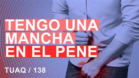 manchas en el pen negras|Manchas en el pene: causas y tratamiento